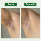 Loción Anti-imperfecciones
